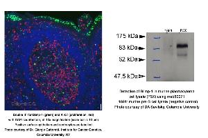 Image no. 7 for anti-Ataxia Telangiectasia Mutated (ATM) (C-Term) antibody (ABIN363380)