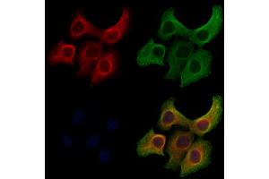 ABIN6261583 and ABIN6272916 staining Hela cells by IF/ICC.