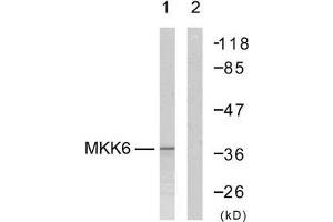 Western blot analysis of extract from MDA-MB-435 cells, using MKK6 (Ab-207) antibody (E021153). (MAP2K6 anticorps)