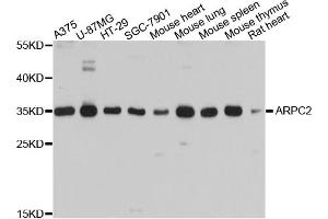 Western blot analysis of extracts of various cell lines, using ARPC2 antibody (ABIN4902949) at 1:1000 dilution. (ARPC2 anticorps)