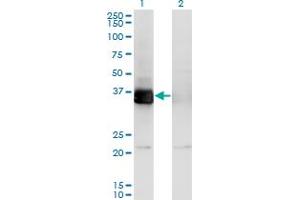 Western Blot analysis of PHF11 expression in transfected 293T cell line by PHF11 monoclonal antibody (M01), clone 3B8.