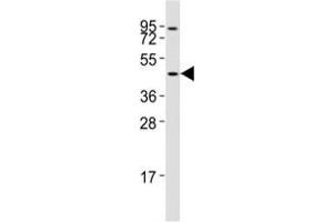 Western blot testing of CCR1 antibody at 1:2000 dilution + Jurkat lysate; Predicted band size : 40-45 kDa.