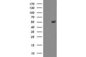 Western Blotting (WB) image for anti-rho GTPase Activating Protein 2 (ARHGAP2) antibody (ABIN1499628) (CHN1 anticorps)