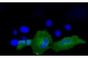Image no. 5 for anti-Proteasome (Prosome, Macropain) 26S Subunit, ATPase, 3 (PSMC3) antibody (ABIN1501335)