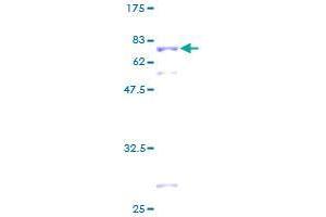 Image no. 1 for Selenophosphate Synthetase 1 (SEPHS1) (AA 1-392) protein (GST tag) (ABIN1319520)