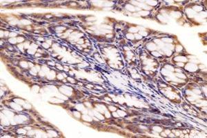 Immunohistochemistry analysis of paraffin-embedded mouse colon using,RRAGB (ABIN7075379) at dilution of 1: 4000 (RRAGB anticorps)