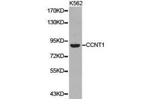 Western Blotting (WB) image for anti-Cyclin T1 (CCNT1) antibody (ABIN1871567) (Cyclin T1 anticorps)