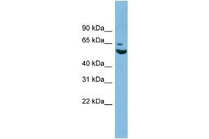 WB Suggested Anti-ZNF563 Antibody Titration: 0. (ZNF563 anticorps  (N-Term))