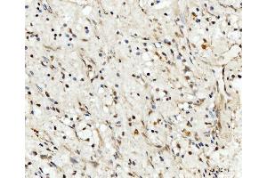 IHC analysis of RRP4/EXOSC2 using anti-RRP4/EXOSC2 antibody (ABIN7602188). (EXOSC2 anticorps  (AA 62-293))