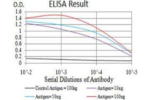 Black line: Control Antigen (100 ng), Purple line: Antigen(10 ng), Blue line: Antigen (50 ng), Red line: Antigen (100 ng), (BMP4 anticorps  (AA 277-408))