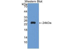 Western Blotting (WB) image for anti-Matrix Metallopeptidase 9 (Gelatinase B, 92kDa Gelatinase, 92kDa Type IV Collagenase) (MMP9) (AA 213-399) antibody (ABIN3201434) (MMP 9 anticorps  (AA 213-399))