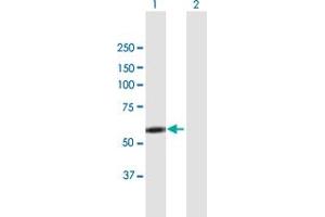 Western Blot analysis of LYN expression in transfected 293T cell line by LYN MaxPab polyclonal antibody. (LYN anticorps  (AA 1-512))