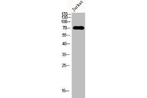 Western Blot analysis of Jurkat cells using DMPK Polyclonal Antibody