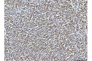 IHC analysis of DUSP6 using anti-DUSP6 antibody (ABIN7599332). (DUSP6 anticorps  (AA 1-381))