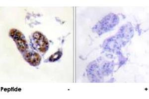 Immunohistochemical analysis of paraffin-embedded human skin tissue using MITF polyclonal antibody . (MITF anticorps  (Ser73, Ser180))