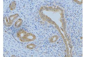ABIN6275102 at 1/100 staining Human uterus tissue by IHC-P. (FBLN4 anticorps  (Internal Region))