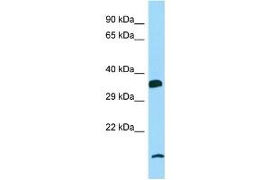 Host: Rabbit Target Name: P2RY6 Sample Type: MCF7 Whole Cell lysates Antibody Dilution: 1.