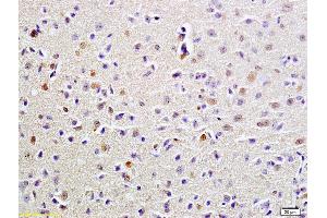 Formalin-fixed and paraffin embedded rat brain labeled with Anti-FUS Polyclonal Antibody, Unconjugated (ABIN682438) at 1:200 followed by conjugation to the secondary antibody and DAB staining (FUS anticorps  (AA 421-526))