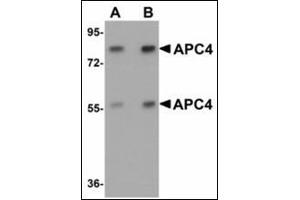 Western blot analysis of APC4 in mouse liver tissue lysate with APC4 antibody at (A) 1 and (B) 2 µg/ml. (ANAPC4 anticorps  (N-Term))