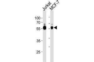 Western Blotting (WB) image for anti-Zinc Finger and SCAN Domain Containing 32 (ZSCAN32) antibody (ABIN3004600) (Zinc Finger and SCAN Domain Containing 32 (ZSCAN32) anticorps)