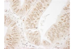 Immunohistochemistry (IHC) image for anti-Bromodomain PHD Finger Transcription Factor (BPTF) (AA 1350-1400) antibody (ABIN7448561) (BPTF anticorps  (AA 1350-1400))