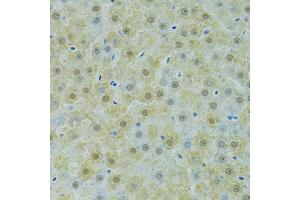 Immunohistochemistry of paraffin-embedded rat liver using SOX14 antibody (ABIN6292418) at dilution of 1:100 (40x lens). (SOX14 anticorps)