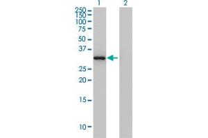 Western Blot analysis of ANXA3 expression in transfected 293T cell line by ANXA3 monoclonal antibody (M12), clone 4F1.