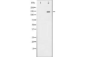 Western blot analysis of Met expression in HepG2 whole cell lysates,The lane on the left is treated with the antigen-specific peptide. (c-MET anticorps  (C-Term))