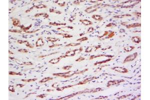 Formalin-fixed and paraffin embedded human kidney labeled with Anti-PRAM1 Polyclonal Antibody, Unconjugated  at 1:200 followed by conjugation to the secondary antibody and DAB staining. (PRAM1 anticorps  (AA 551-650))