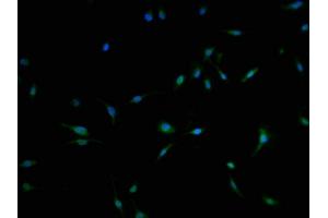 Immunofluorescence staining of U251 cells with ABIN7174848 at 1:100, counter-stained with DAPI. (C3orf38 anticorps  (AA 80-329))