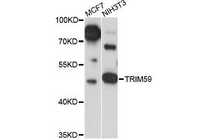 Western blot analysis of extracts of various cell lines, using TRIM59 antibody (ABIN6293638) at 1:1000 dilution.