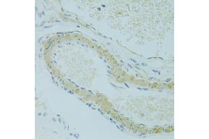 Immunohistochemistry of paraffin-embedded rat ovary using IFT57 antibody (ABIN6292987) at dilution of 1:100 (40x lens). (IFT57 anticorps)