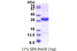 SDS-PAGE (SDS) image for V-Set Domain Containing T Cell Activation Inhibitor 1 (VTCN1) (AA 25-259) protein (His tag) (ABIN5853439)