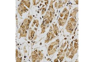 Immunohistochemistry of paraffin-embedded human stomach using GSTT1 antibody at dilution of 1:200 (x400 lens)