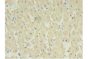 Immunohistochemistry of paraffin-embedded human heart tissue using ABIN7170733 at dilution of 1:100