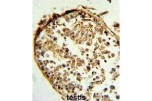 Immunohistochemistry (IHC) image for anti-Cathepsin S (CTSS) antibody (ABIN3003177) (Cathepsin S anticorps)