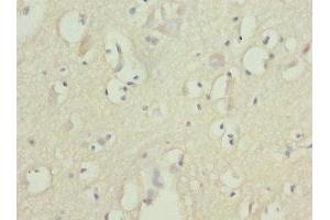 Immunohistochemistry of paraffin-embedded human brain tissue using ABIN7152580 at dilution of 1:100 (FASTK anticorps  (AA 360-549))