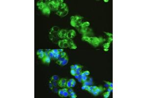 Immunofluorescence analysis of HepG2 cells using GOLG antibody (4688) at dilution of 1:150.