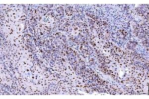 IHC analysis of Cdk2 using anti-Cdk2 antibody (ABIN7602522). (CDK2 anticorps  (AA 81-298))
