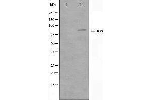 Western blot analysis on HepG2 cell lysate using HGS Antibody.