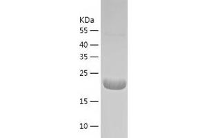Western Blotting (WB) image for V-Ral Simian Leukemia Viral Oncogene Homolog B (Ras Related, GTP Binding Protein) (Ralb) (AA 1-203) protein (His-IF2DI Tag) (ABIN7125683)
