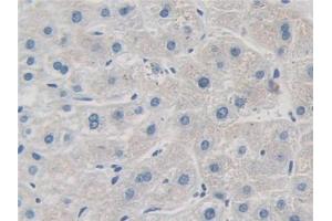 DAB staining on IHC-P; Samples: Human Liver Tissue