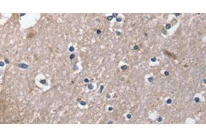 Immunohistochemistry of paraffin-embedded Human brain using DUT Polyclonal Antibody at dilution of 1:30