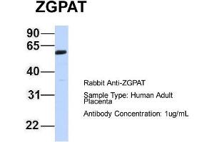Host: Rabbit Target Name: ZGPAT Sample Type: Human Adult Placenta Antibody Dilution: 1. (ZGPAT anticorps  (Middle Region))