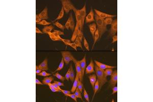 Immunofluorescence analysis of NIH-3T3 cells using  Rabbit mAb (ABIN7265669) at dilution of 1:100 (40x lens).