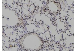 ABIN6278303 at 1/100 staining Mouse lung tissue by IHC-P. (Plakophilin 3 anticorps  (C-Term))