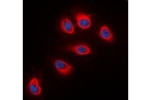 Immunofluorescent analysis of RPS6 staining in HeLa cells. (RPS6 anticorps  (C-Term))
