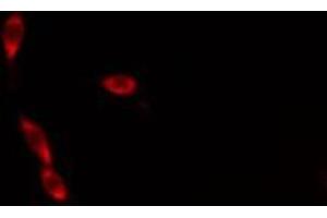 ABIN6276306 staining  Hela cells by IF/ICC.