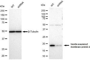 Western blotting analysis using Vesicle associated membrane protein 2 antibody (ABIN7800830). (Recombinant VAMP2 anticorps)