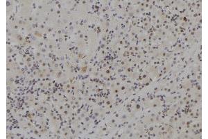 ABIN6257825 and ABIN6273704 at 1/100 staining Human liver tissue by IHC-P. (MCM9 anticorps  (C-Term))